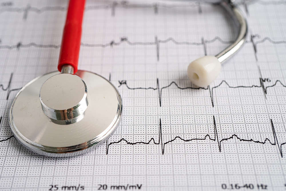 check-up electrocardiogramme