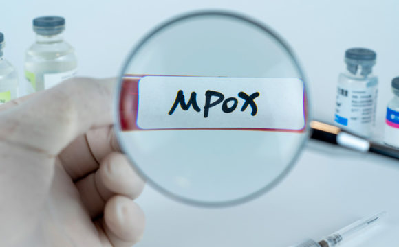 Virus Mpox